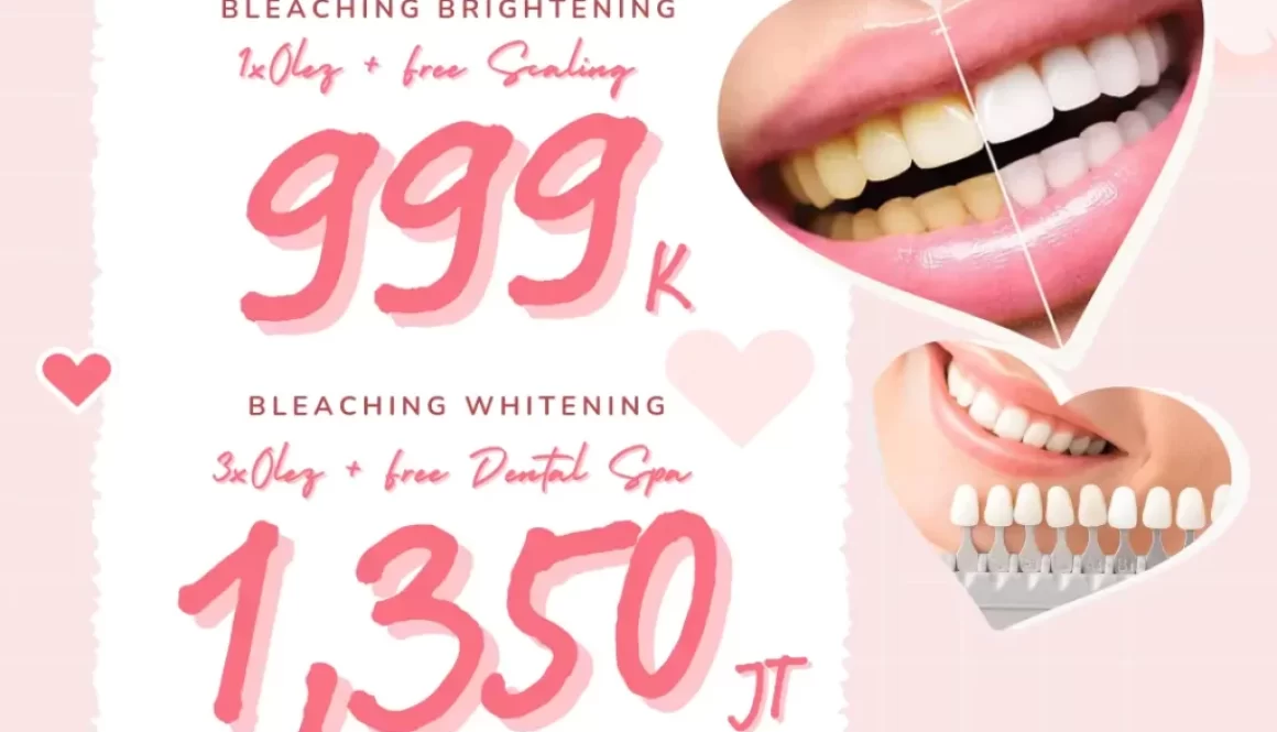 Promo Harga Bleaching 1.350K di Dokter Gigi Terbaik